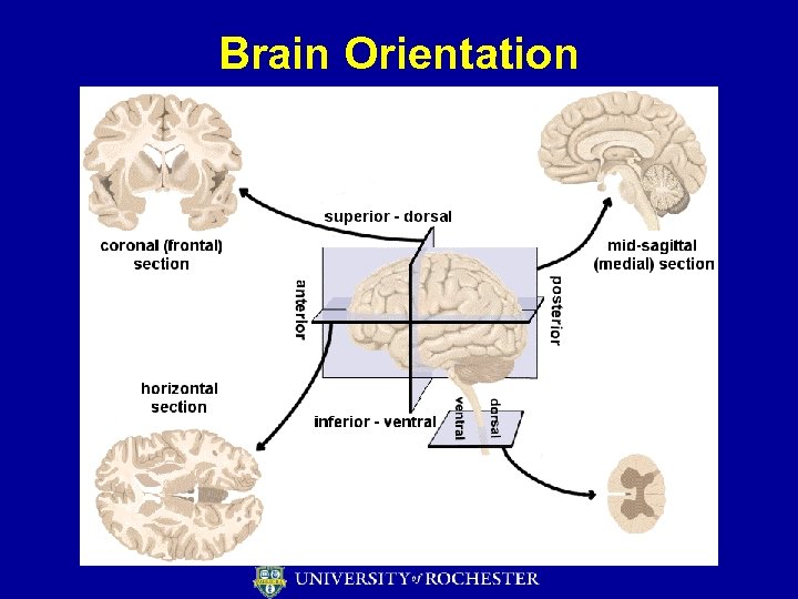 Brain Orientation 