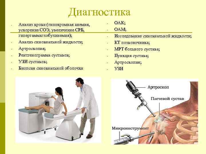  Диагностика - - Анализ крови (гипохромная анемия, ускорение СОЭ, увеличение СРБ, гипергаммаглобулинемия); Анализ