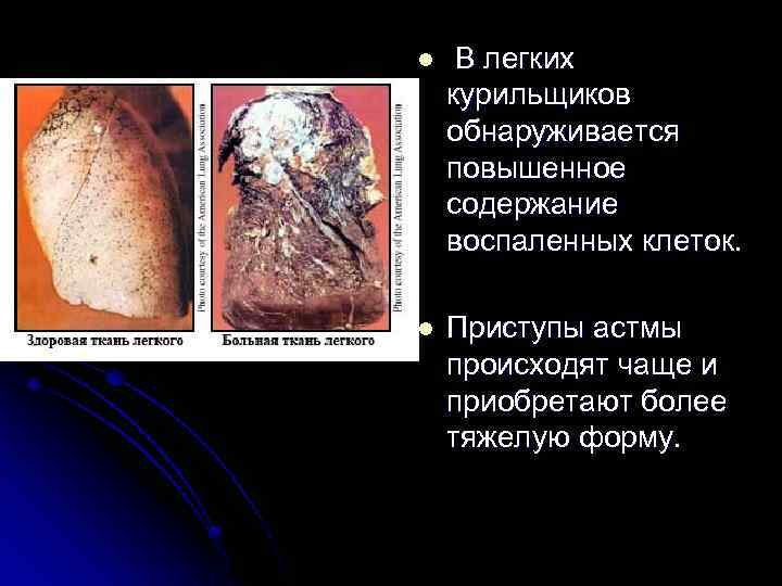 l В легких курильщиков обнаруживается повышенное содержание воспаленных клеток. l Приступы астмы происходят чаще