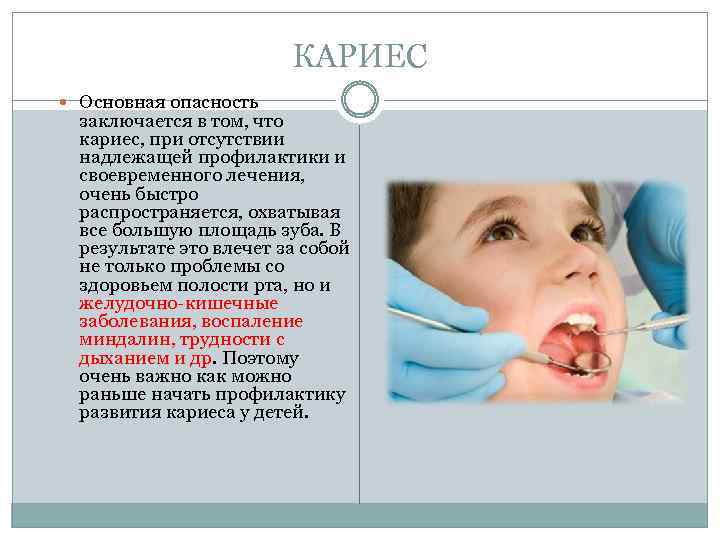 КАРИЕС Основная опасность заключается в том, что кариес, при отсутствии надлежащей профилактики и своевременного