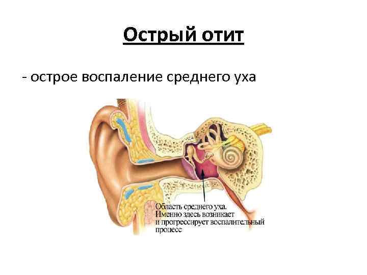 Воспаление внутреннего уха лечение. Строение уха и средний отит. Острый наружный средний отит. Строение уха человека схема отит.