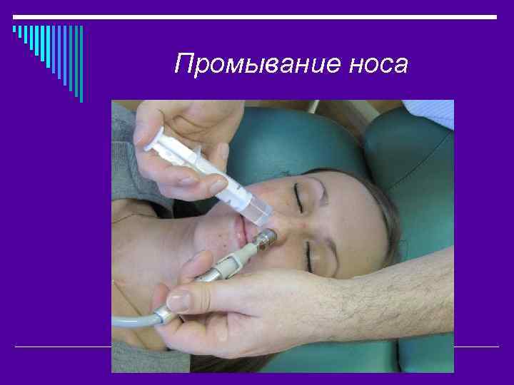 Промывание носа 