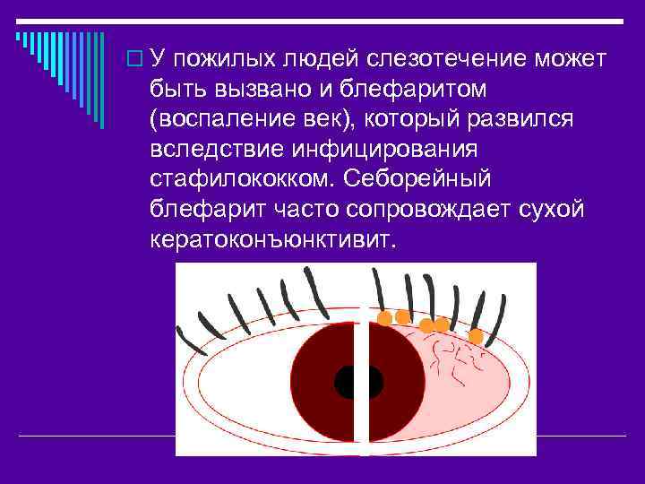 o У пожилых людей слезотечение может быть вызвано и блефаритом (воспаление век), который развился