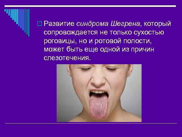 o Развитие синдрома Шегрена, который сопровождается не только сухостью роговицы, но и ротовой полости,