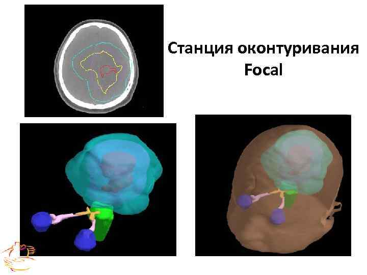 Станция оконтуривания Focal 
