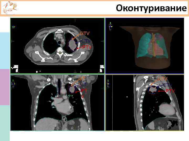 На формирование кт изображения оказывает непосредственное влияние