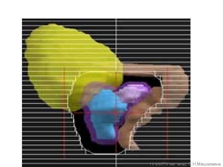 ННИИПК им. акад. Е. Н. Мешалкина 