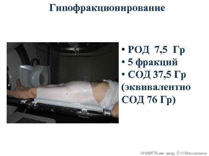 Гипофракционирование • РОД 7, 5 Гр • 5 фракций • СОД 37, 5 Гр