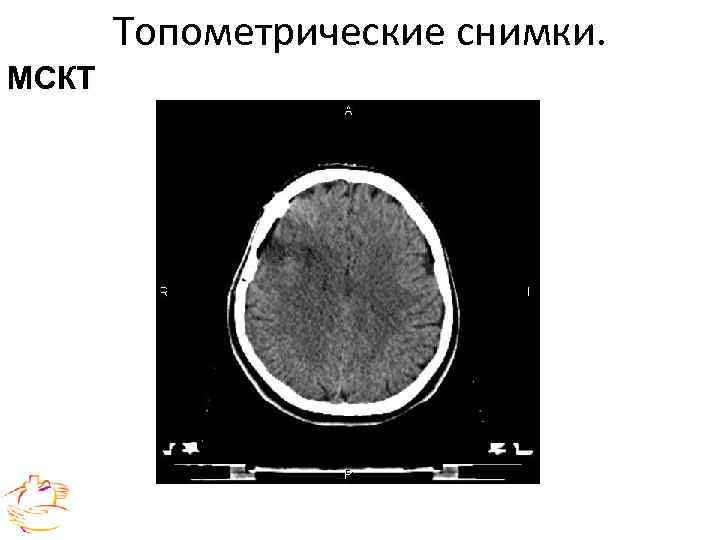 Топометрические снимки. МСКТ 