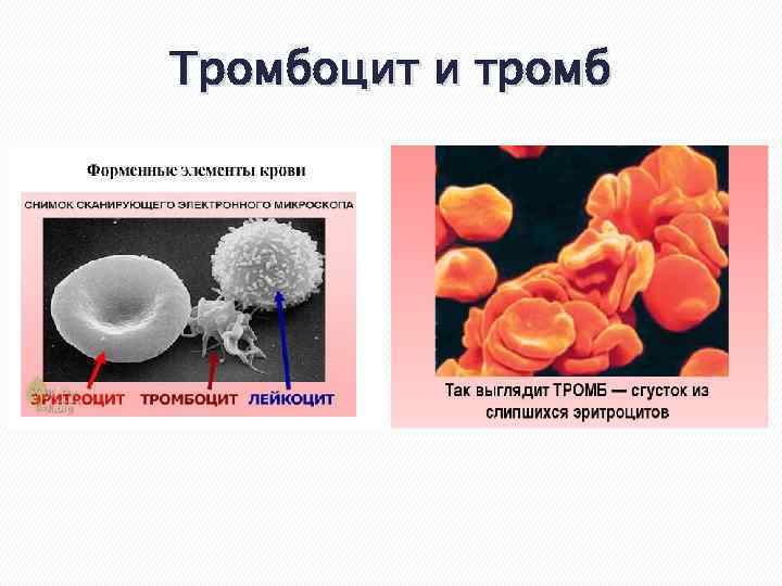 Тромбоцит и тромб 