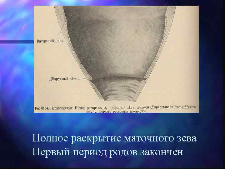 Полное раскрытие маточного зева Первый период родов закончен 