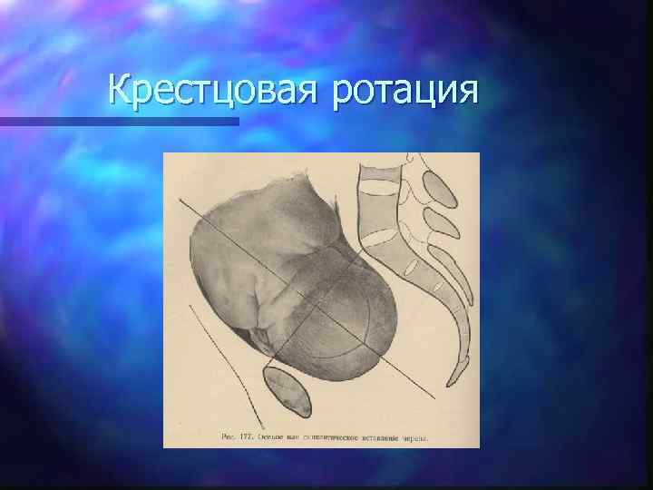 Крестцовая ротация 