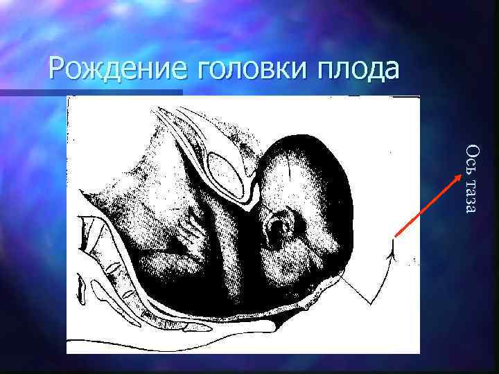 Рождение головки плода Ось таза 