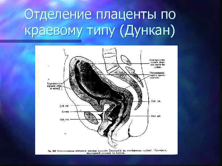 Отделение плаценты по краевому типу (Дункан) 