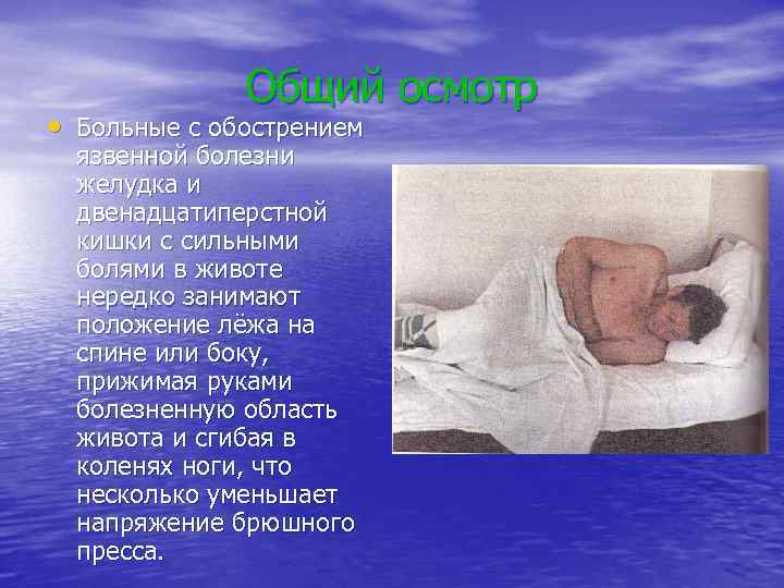 Общий осмотр • Больные с обострением язвенной болезни желудка и двенадцатиперстной кишки с сильными