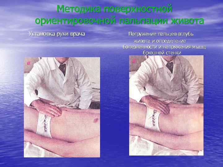 Методика поверхностной ориентировочной пальпации живота Установка руки врача Погружение пальцев вглубь живота и определение