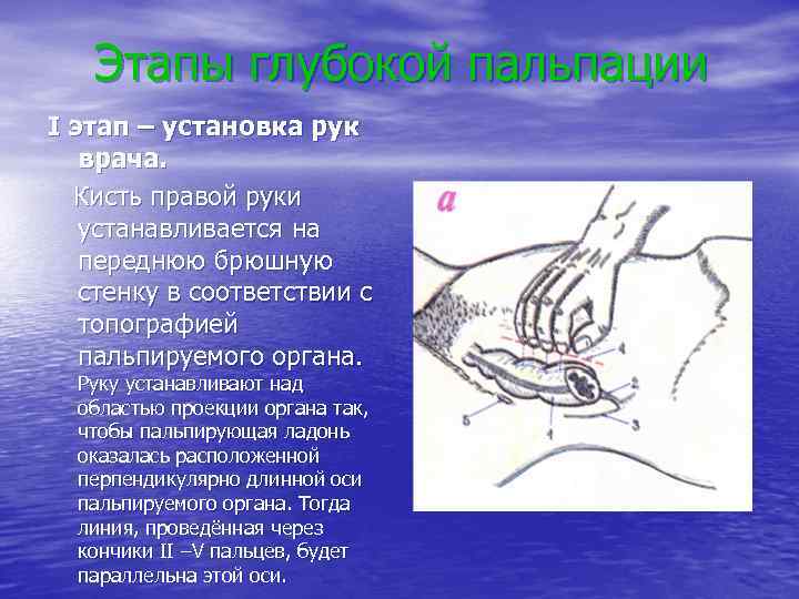 Этапы глубокой пальпации I этап – установка рук врача. Кисть правой руки устанавливается на