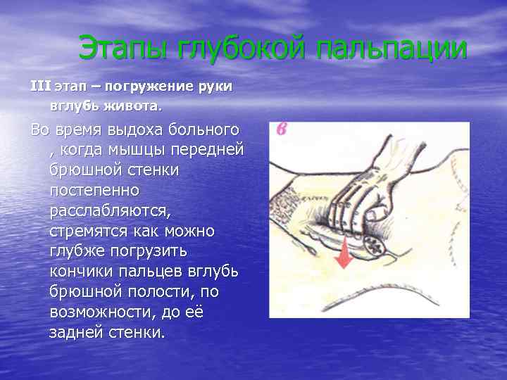 Этапы глубокой пальпации III этап – погружение руки вглубь живота. Во время выдоха больного