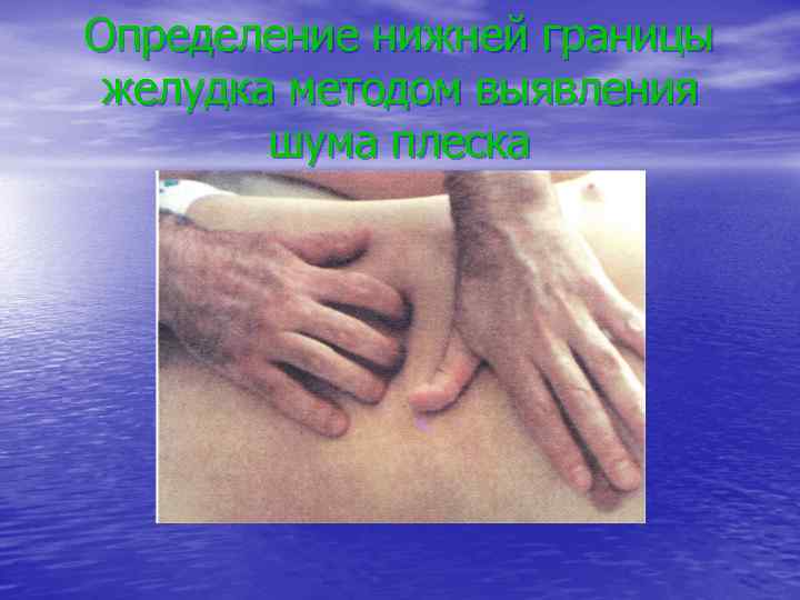 Определение нижней границы желудка методом выявления шума плеска 