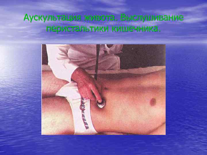 Аускультация живота. Выслушивание перистальтики кишечника. 