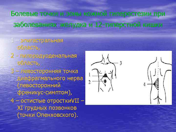 Болевые точки и зоны кожной гиперестезии при заболеваниях желудка и 12 -типерстной кишки 1