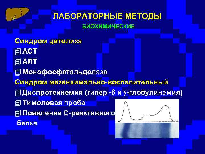 ЛАБОРАТОРНЫЕ МЕТОДЫ БИОХИМИЧЕСКИЕ Синдром цитолиза 4 АСТ 4 АЛТ 4 Монофосфатальдолаза Синдром мезенхимально-воспалительный 4
