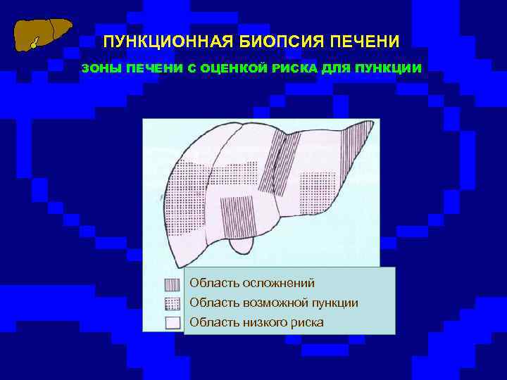 ПУНКЦИОННАЯ БИОПСИЯ ПЕЧЕНИ ЗОНЫ ПЕЧЕНИ С ОЦЕНКОЙ РИСКА ДЛЯ ПУНКЦИИ Область осложнений Область возможной