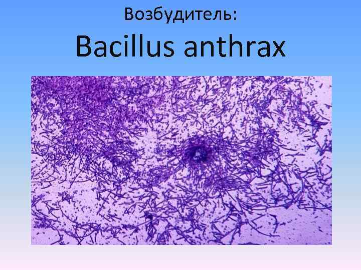 Возбудитель: Bacillus anthrax 