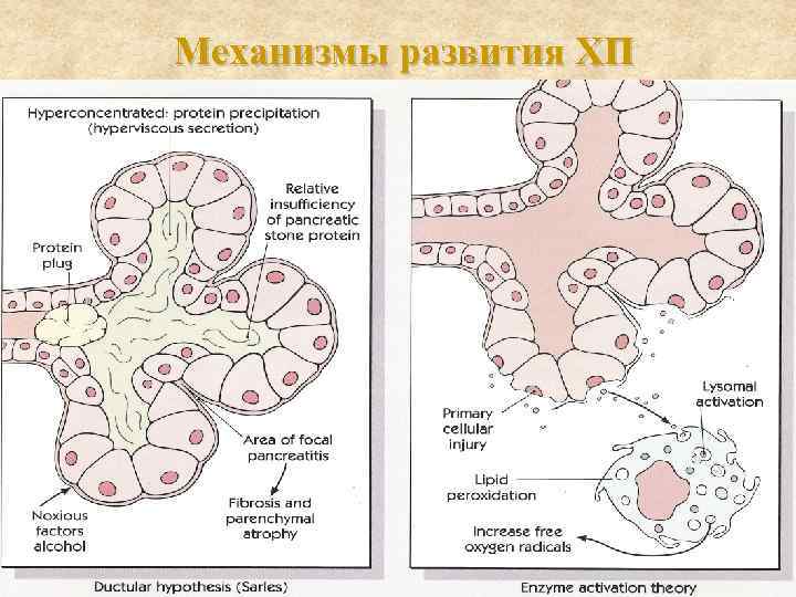 Механизмы развития ХП 