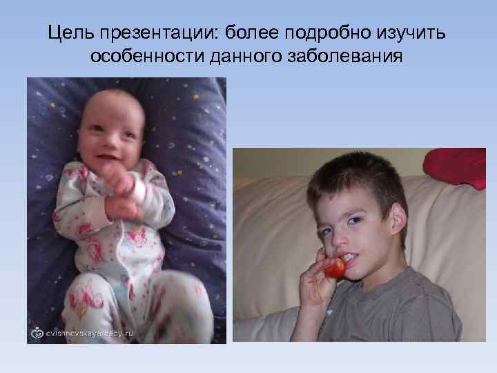 Цель презентации: более подробно изучить особенности данного заболевания 