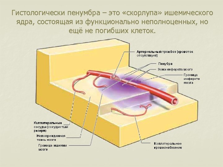 Гистологически пенумбра – это «скорлупа» ишемического ядра, состоящая из функционально неполноценных, но ещё не