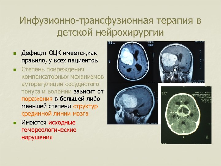 Инфузионно-трансфузионная терапия в детской нейрохирургии n n n Дефицит ОЦК имеется, как правило, у