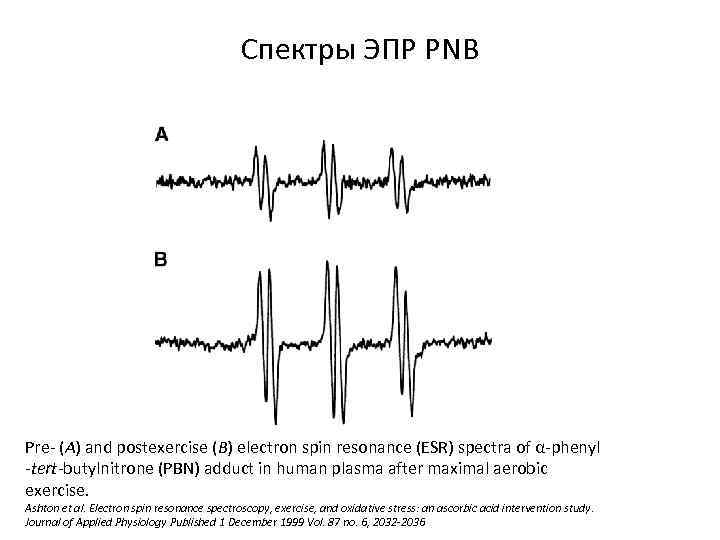 Спектры ЭПР PNB Pre- (A) and postexercise (B) electron spin resonance (ESR) spectra of