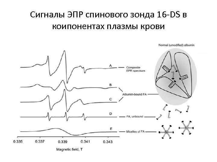 Сигналы ЭПР спинового зонда 16 -DS в коипонентах плазмы крови 