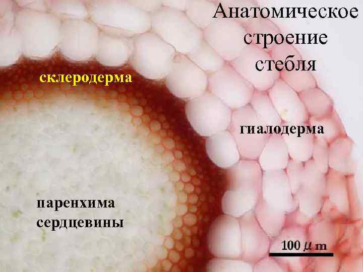 склеродерма Анатомическое строение стебля гиалодерма паренхима сердцевины 