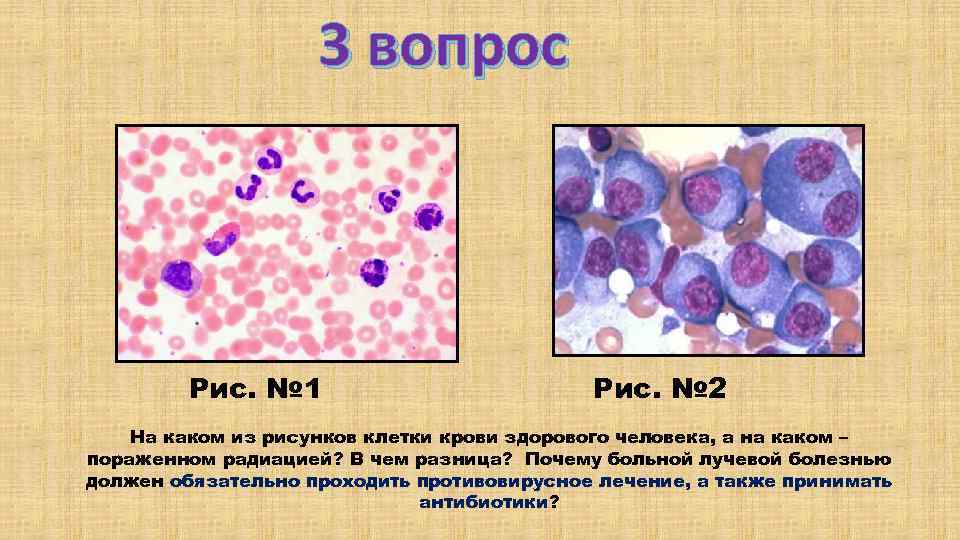 3 вопрос Рис. № 1 Рис. № 2 На каком из рисунков клетки крови