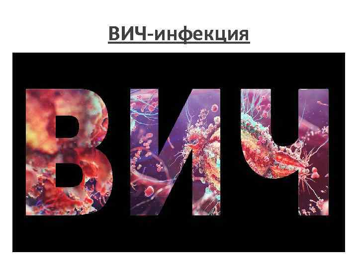 ВИЧ-инфекция 