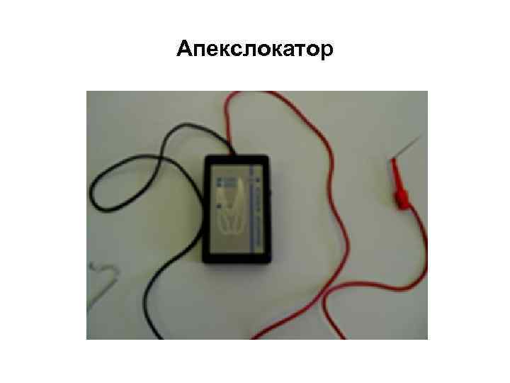 Апекслокатор 