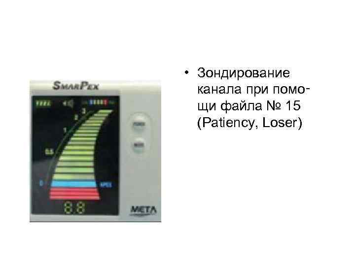  • Зондирование канала при помо‑ щи файла № 15 (Patiency, Loser) 