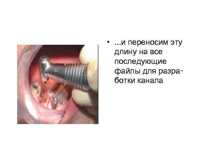  • . . . и переносим эту длину на все последующие файлы для