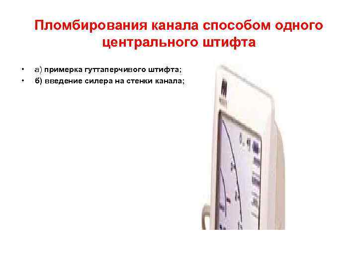 Пломбирования канала способом одного центрального штифта • • а) примерка гуттаперчивого штифта; б) введение