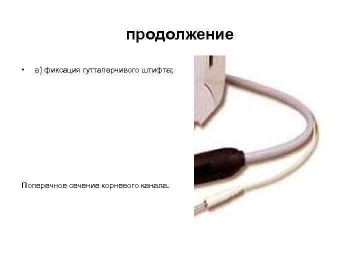 продолжение • в) фиксация гуттаперчивого штифта; Поперечное сечение корневого канала. 