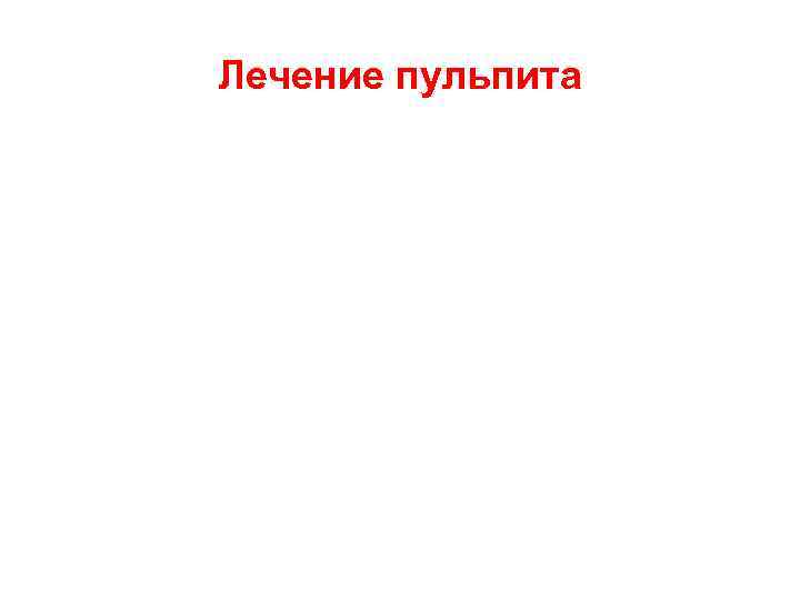 Лечение пульпита 