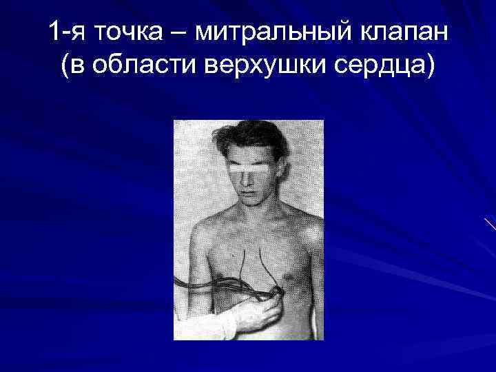 1 -я точка – митральный клапан (в области верхушки сердца) 