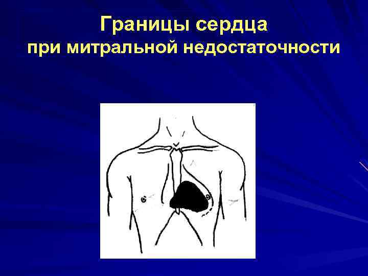 Границы сердца при митральной недостаточности 