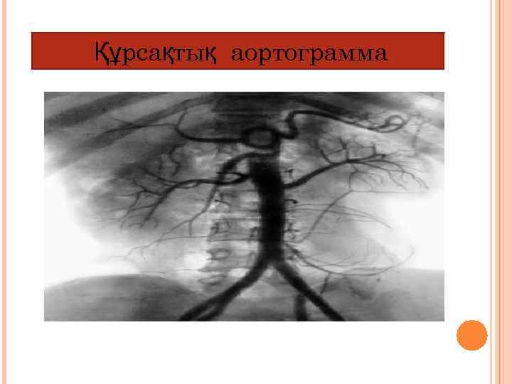 Құрсақтық аортограмма 