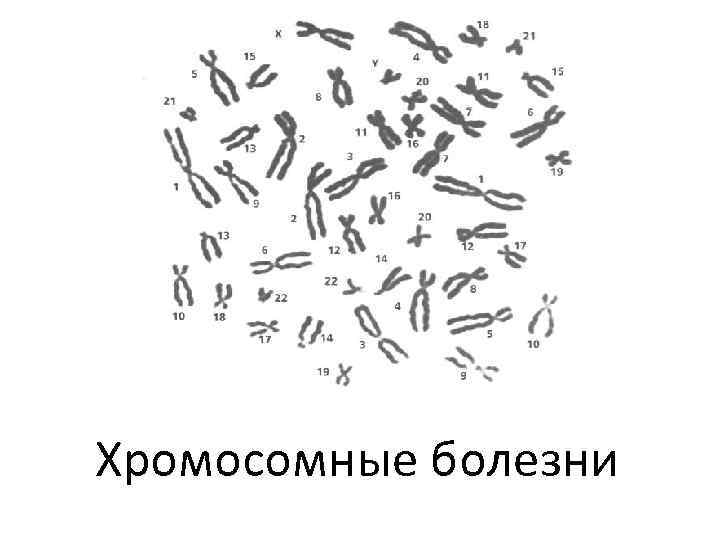Хромосомные болезни 