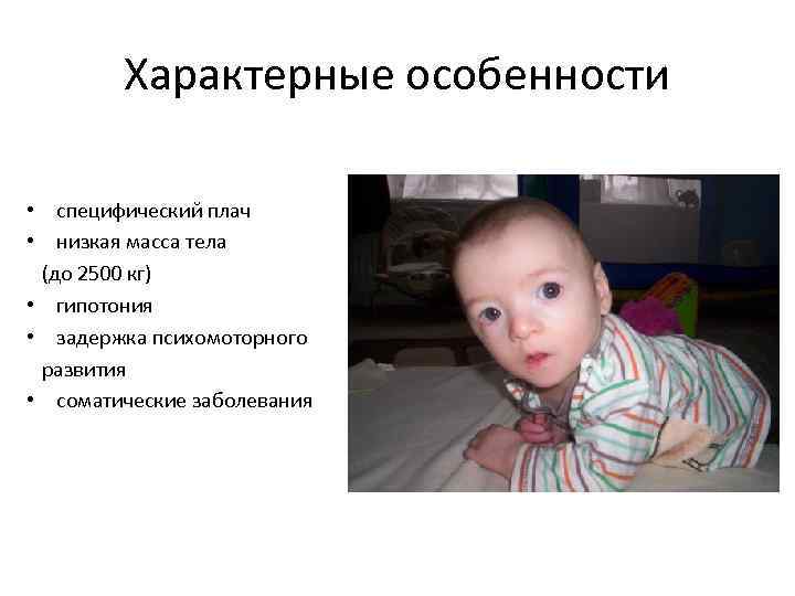 Характерные особенности • специфический плач • низкая масса тела (до 2500 кг) • гипотония