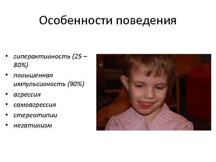 Особенности поведения • гиперактивность (25 – 80%) • повышенная импульсивность (90%) • агрессия •