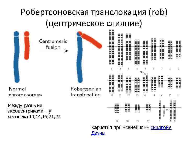 Робертсоновская транслокация (rob) (центрическое слияние) Между разными акроцентриками – у человека 13, 14, 15,